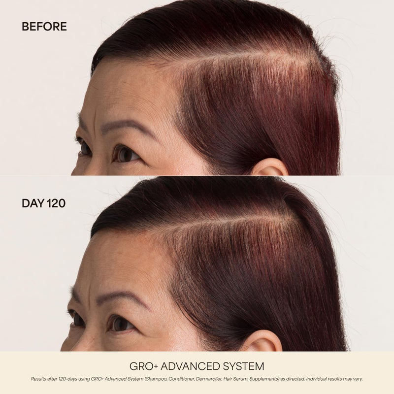 VEGAMOUR GRO+ Advanced Hair Growth Vitamin Supplements - Boosts Hair Growth & Density - 30 Pill Packs/Box - Image 3