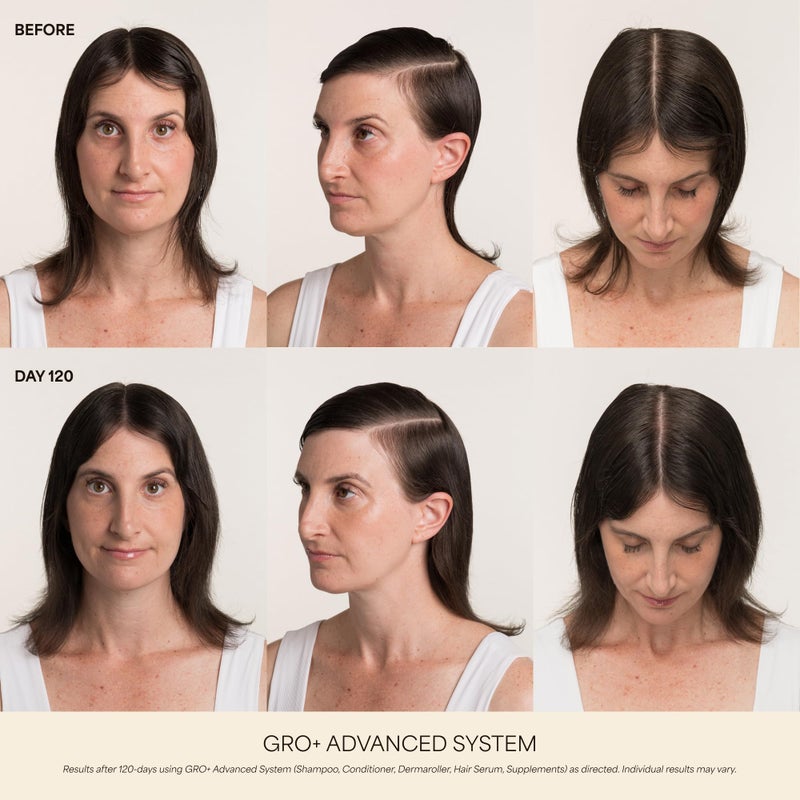 VEGAMOUR GRO+ Advanced Hair Growth Vitamin Supplements - Boosts Hair Growth & Density - 30 Pill Packs/Box - Image 2