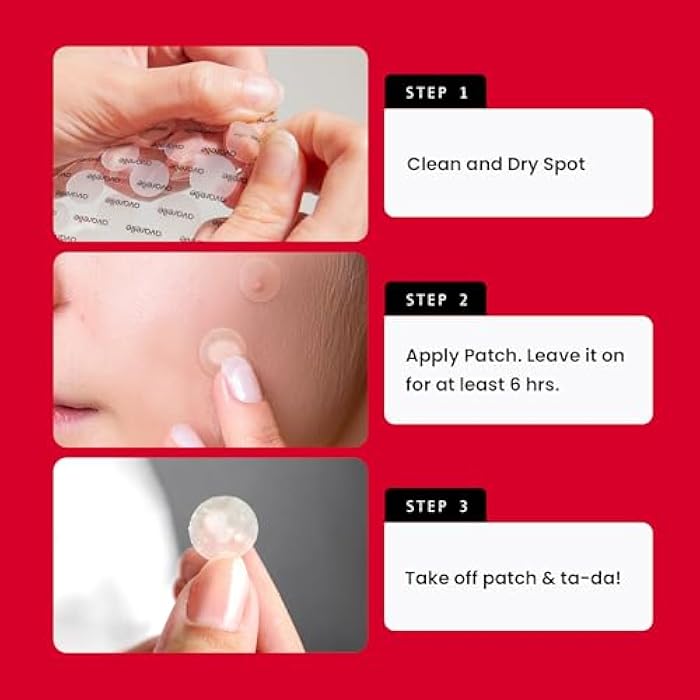 AVARELLE Acne Pimple Patch (40 Count) Absorbing Hydrocolloid Spot Treatment with Tea Tree Oil, Calendula Oil and Cica, Certified Vegan, Cruelty Free (VARIETY / 40 COUNT) - Image 5