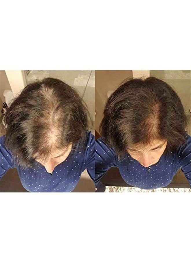 Zenagen Revolve Thickening Hair Loss Treatment for Women, 6 Fl Oz  - Image 2