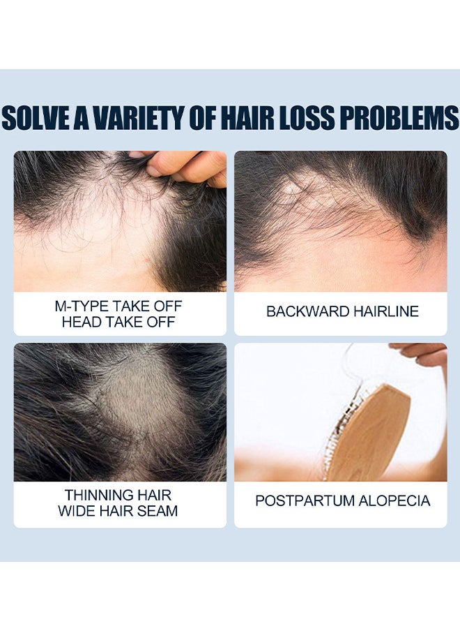 East Moon - Scalp Care Hair Growth Spray, Ultra Hair Growth Formula Serum Spray, Damaged Dry Hair, Hair Regrowth for Thicker Longer Fuller Hair, 30ML - Image 1