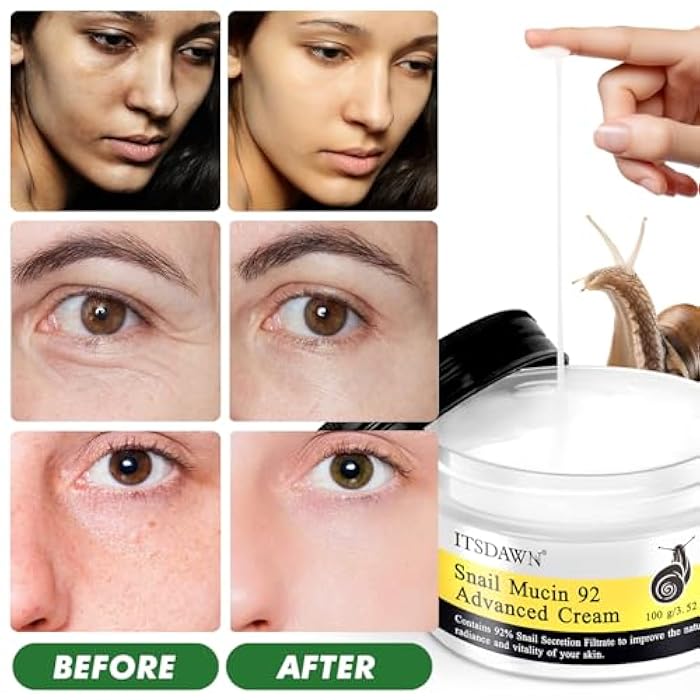 ITSDAWN 2 Pack Snail Mucin 92% Face Cream 100g, Moisturizer Hydrating Cream for Dry & Sensitive Skin, All Skin Types - Image 5