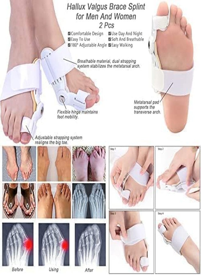 KD ZONE Bunion Corrector Toe Splint, Adjustable Orthopedic Support Brace, White - Image 4