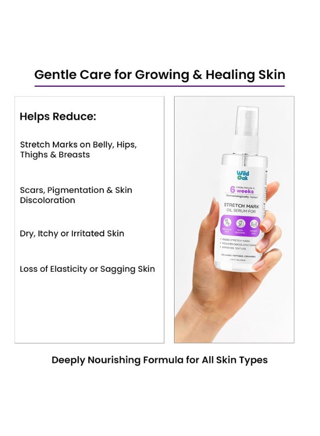 WILD OAK WildOak Stretch Mark Oil for Men & Women | 100ml | With Tiger Grass (Centella Asiatica), Bakuchiol, Peptides, Ceramides & Vitamin E | Pregnancy, Postpartum, Gym | Reduces Stretch Marks & Scars - Image 2