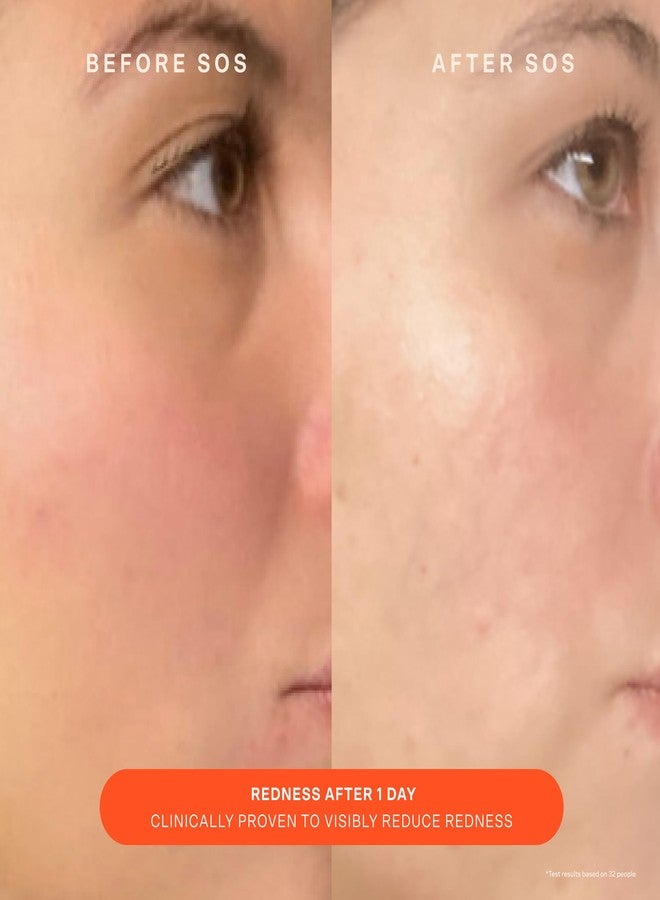 Tower 28 Beauty SOS Daily Skin Barrier Redness Recovery Moisturizer 1.86 oz / 52.73 g - Image 3