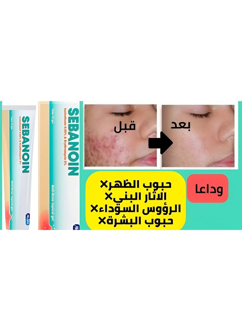 ميلانو سيبانوين جل لعلاج حب الشباب 15جم - Image 5