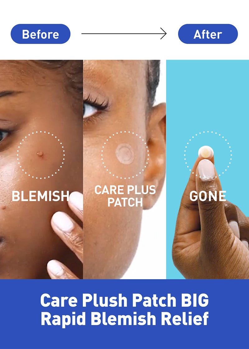 OLIVE YOUNG Care Plus Spot Patch | Hydrocolloid Acne Korean Spot Patch to Cover Zits, Pimples and Blemishes, for Troubled Skin and Face (Hydrocolloid, 102 Count (Pack of 1)) - Image 2