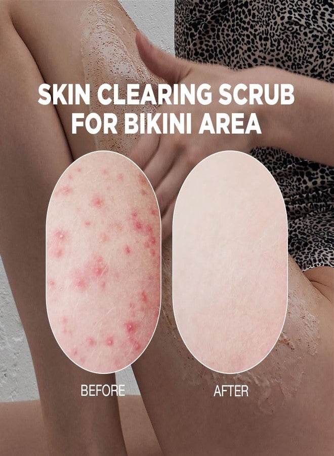 Proot Bikini Exfoliating Scrub | Advanced Exfoliating Scrub For Bikini Area | Bikini Scrub Exfoliator For Intimate Area | Bikini Bumps Treatment For Women | Bikini Exfoliating Scrub for Intensive Skincare - Image 3