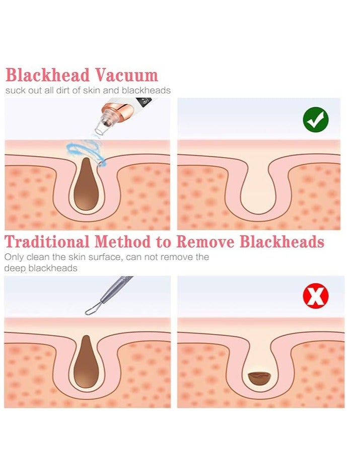Generic Blackhead Remover Pore Vacuum Electric Facial Pore Cleaner Acne White Head Pimple Extractor USB Rechargeable Blackhead Removal Tool-3 Suction Power,5 Probes for Women & Men  - Image 3
