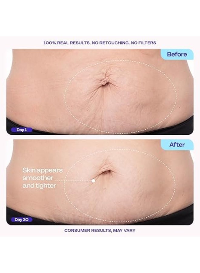 goPure Firming Belly Cream - Body Firming Moisturizer for Visible Cellulite & Stretch Mark Reduction, 4.25oz - Image 3