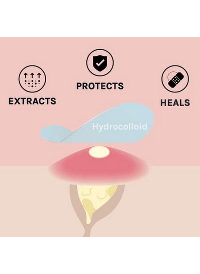 AOA STUDIO AOA STUDIO Absorbing Cover Healing Invisible Acne Patch Blemish Spot, Treatment, Facial Acne Patch Vegan, Cruelty Free, Hydrocolloid, Two Sizes 10mm 12mm (Total 84 Counts)  - Image 3
