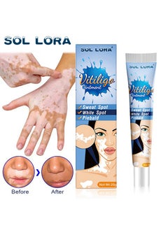 SOL LORA SOL LORA spot care health cream, white spot clean ointment spot pityriasis vitiligo skin external cream  - Image 2