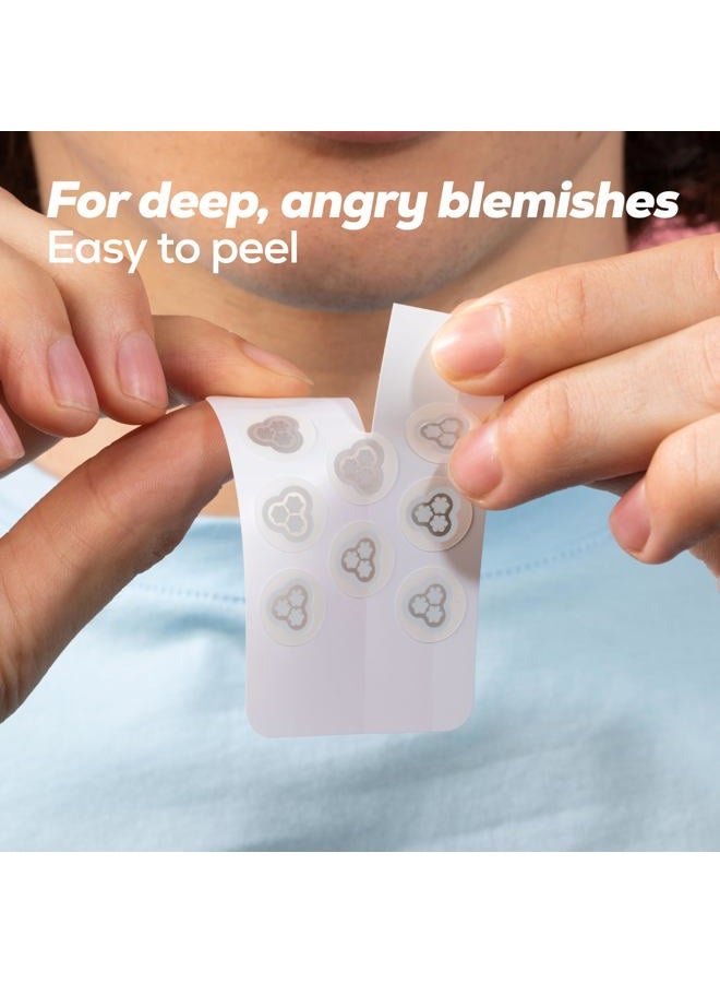 Hanhoo EraseZit Magnesium Microneedle Patch, 8 Microneedle Patches, Hydrocolloid Pimple Patches, For Deep Pimples, Calms Angry Zits, Acne Spot Patches, Microdot Pimple Patches, Korean Skincare - Image 4