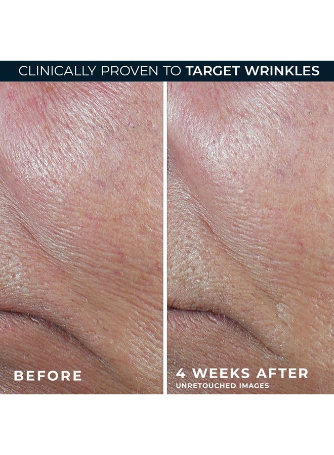 RoC سيروم ديرم كوركسيون المتقدم لتقوية الريتينول على شكل عصا مع مضادات الأكسدة لشد وتجديد التجاعيد وخطوط الضحك بشكل مرئي، 1.0 أونصة مع عينة من كريم العين بالريتينول - Image 5