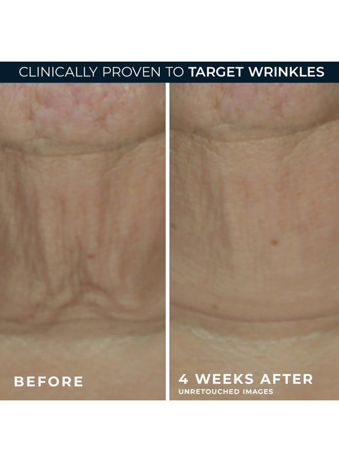 RoC سيروم ديرم كوركسيون المتقدم لتقوية الريتينول على شكل عصا مع مضادات الأكسدة لشد وتجديد التجاعيد وخطوط الضحك بشكل مرئي، 1.0 أونصة مع عينة من كريم العين بالريتينول - Image 4