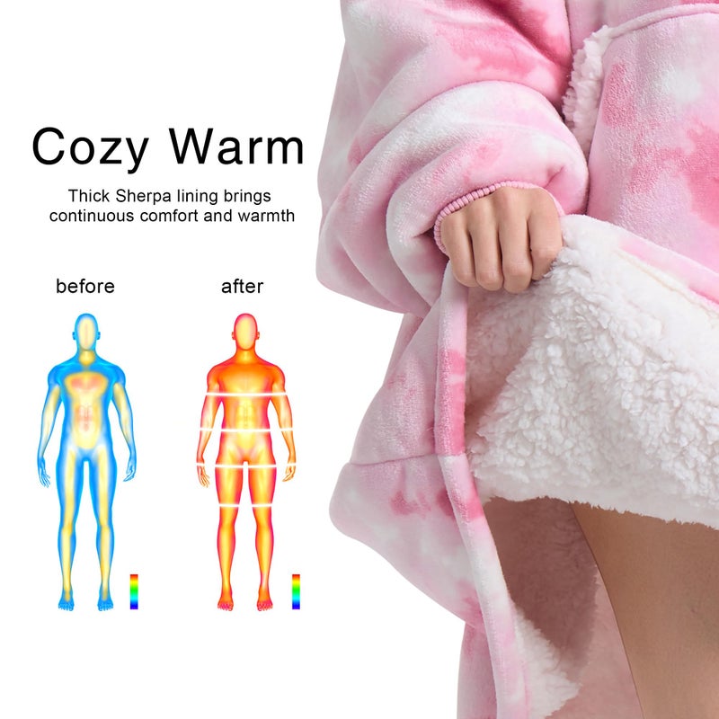 Kipswiza Wearable Blanket Hoodie - Oversized Hooded Blanket Adult  Thick Warm Sherpa Fleece Blanket Sweatshirt for Women Teens Girls Gifts  Pink Tie-dye