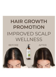 velona velona Castor Oil with Rosemary Oil - 8 oz | Hair Growth Oil | Hair, Scalp, Eyelashes, Eyebrows | 100% Natural and Pure  - Image 2