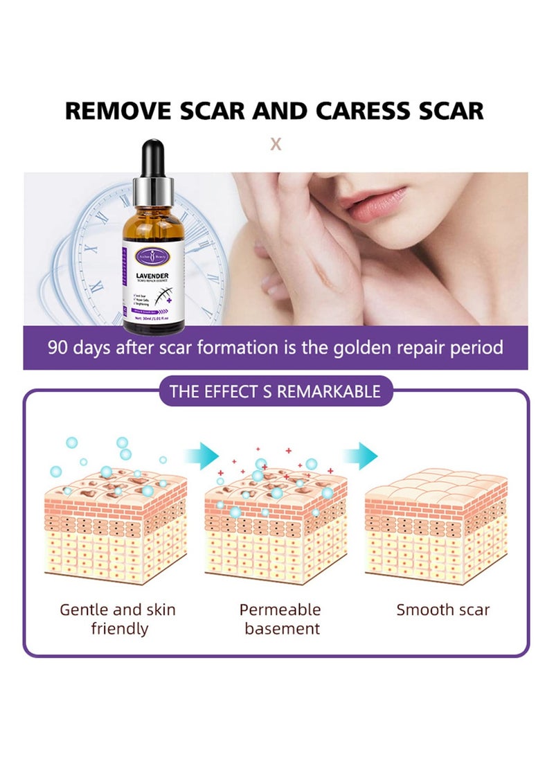 Pack Of 2 Scars Repair Essence Lavender Extract Essential Oil Anti Scar Repair Cells Shiny Smooth Skin Care 2 X 30ml