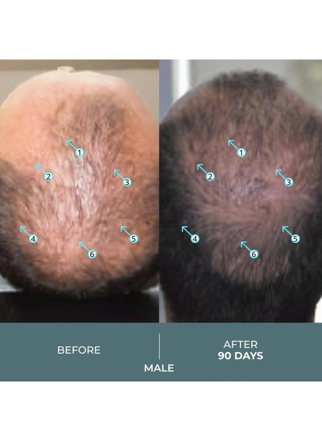 DS LABORATORIES DS Laboratories Spectral.F7 Hair Serum - Hair Regrowth Treatment for Men & Women, Astressin-B & Copper Peptides Hair Growth Serum, Hair Loss Products & Hair Thickening Products for Women & Men  - Image 3