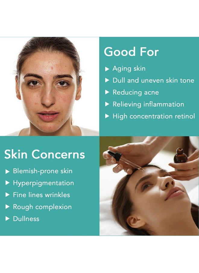ELBBUB - Retinol Serum - Retinol Liposome Delivery System with Hyaluronic Acid and Vitamin E, Aloe, Anti Aging Retinol Serum for Skin Repair, Fine Line and Wrinkles - Image 1