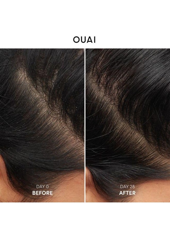 Ouai - OUAI Anti Dandruff Shampoo - Soothing Salicylic Acid Shampoo for Flaky, Dry and Itchy Scalp - Reduces Itching, Redness and Irritation - Sulfate Free Scalp Care (10 Fl Oz) - Image 1