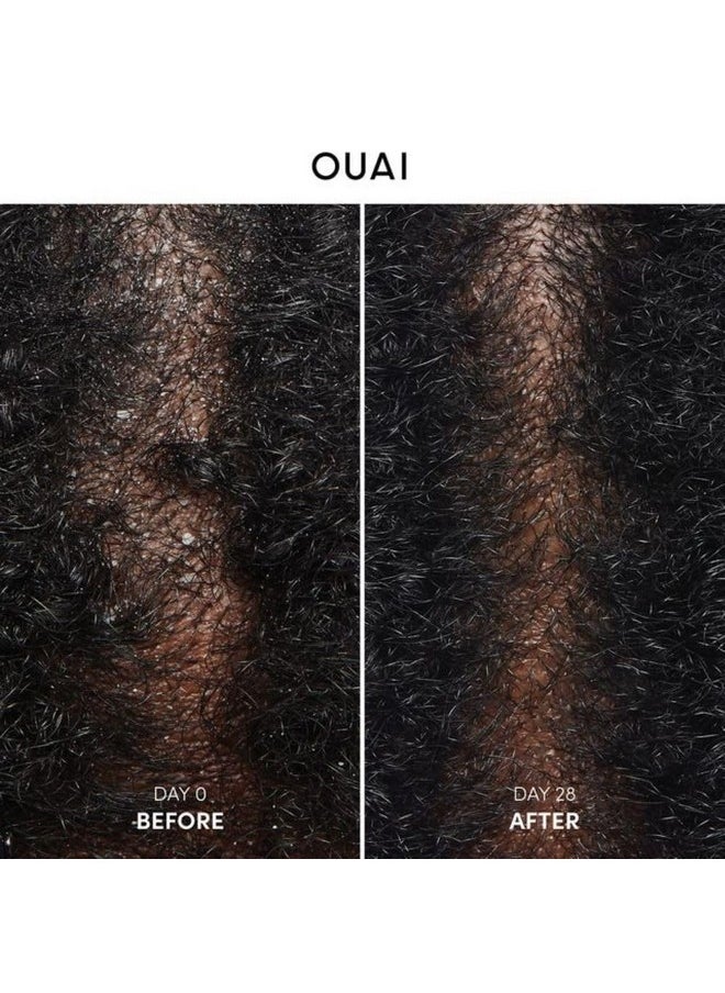 Ouai - OUAI Anti Dandruff Shampoo - Soothing Salicylic Acid Shampoo for Flaky, Dry and Itchy Scalp - Reduces Itching, Redness and Irritation - Sulfate Free Scalp Care (10 Fl Oz) - Image 1