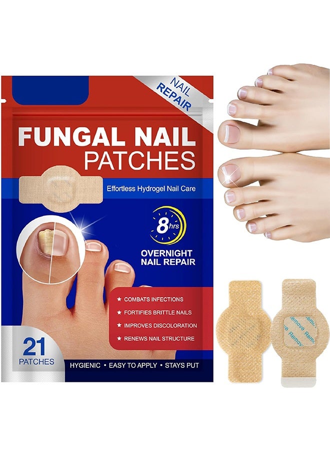 ATRJSZ Fungal Nail Repair Patches – Effective Care Solution for Healthy, Strong Toenails – Easy-to-Use, Fast-Acting & Long-Lasting Results - Image 1