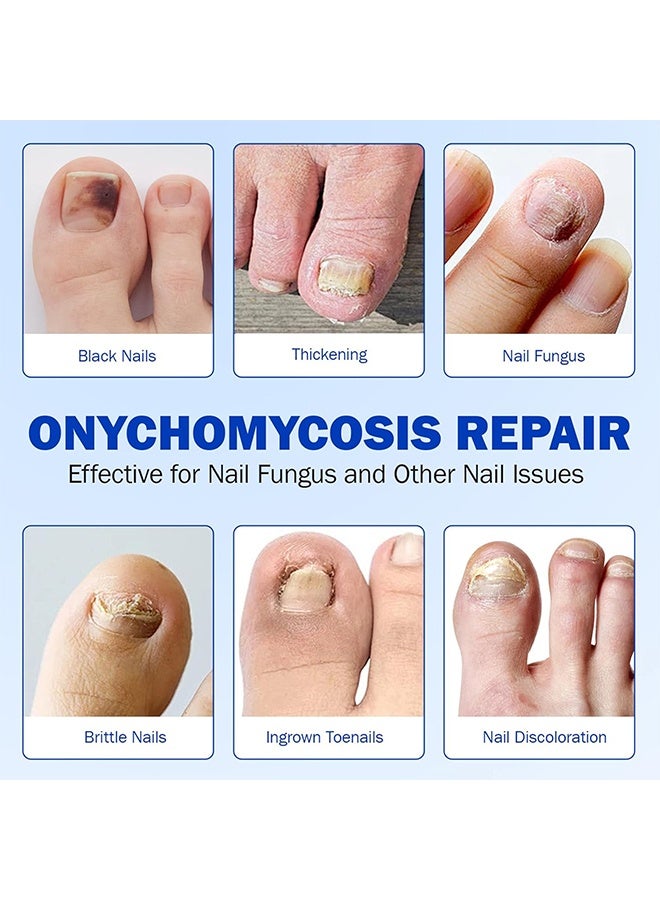 ATRJSZ Fungal Nail Repair Patches – Effective Care Solution for Healthy, Strong Toenails – Easy-to-Use, Fast-Acting & Long-Lasting Results - Image 3