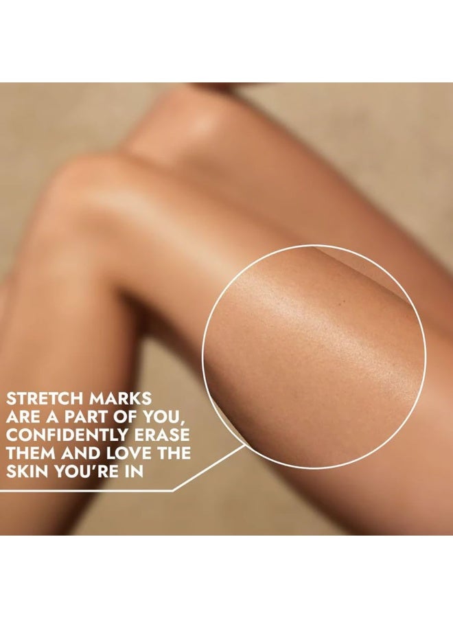 "كوز آي كيو" سيروم كوز-آي كيو لإزالة علامات التمدد مع ستريوفر | إزالة الندبات | توحيد لون البشرة | جميع أنواع البشرة | 40 مل - Image 2