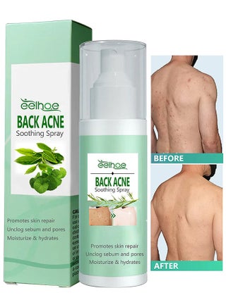 EELHOE 120ML Back Acne Treatment Soothing Spay, Back Acne Spray