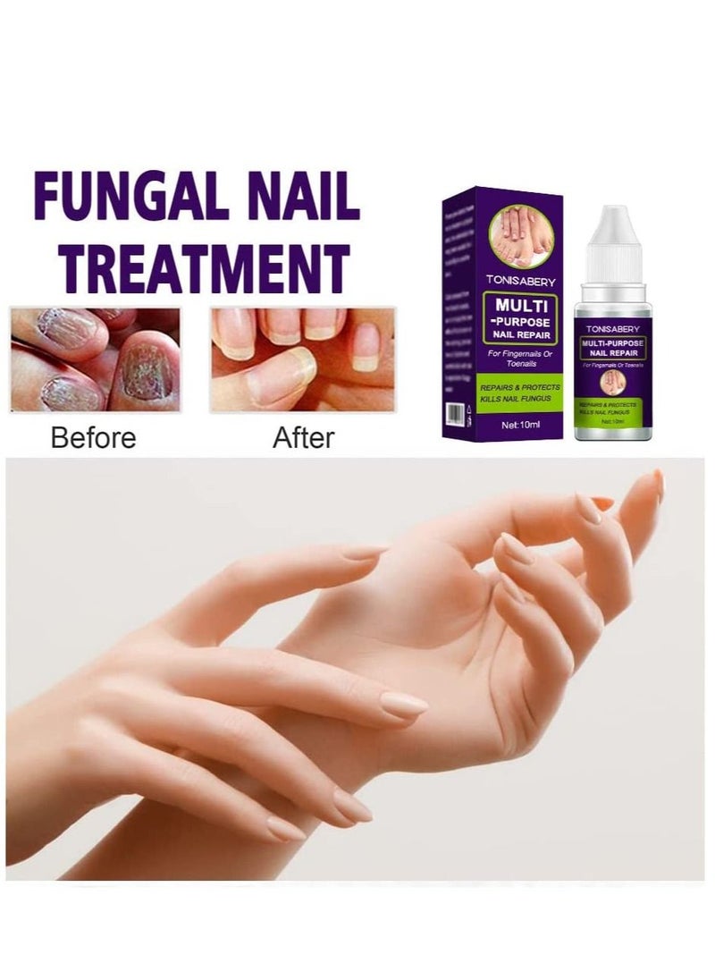 TONISABERY - Fungal Nail Repair Solution Natural Safe & Effective Repairs Protects Cuticles Removes Nail Infections Nourishing Fluid for Fingernails Toenails Remove Onychomycosis Unisex 10ml - Image 1
