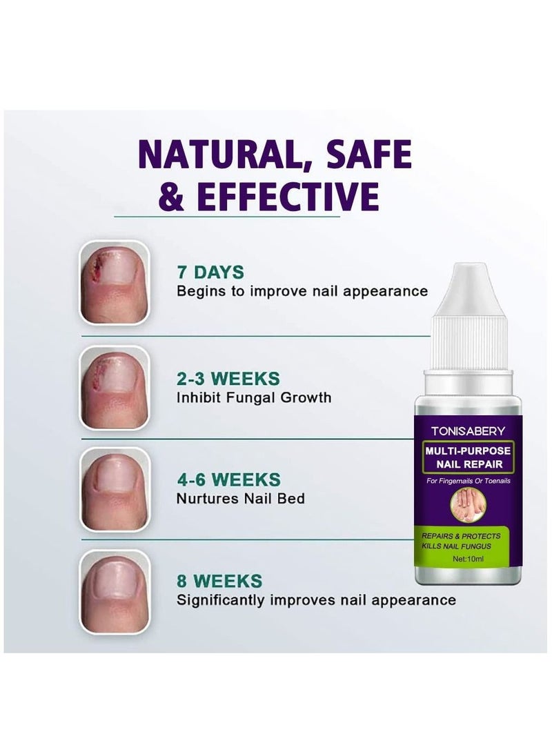 TONISABERY - Fungal Nail Repair Solution Natural Safe & Effective Repairs Protects Cuticles Removes Nail Infections Nourishing Fluid for Fingernails Toenails Remove Onychomycosis Unisex 10ml - Image 1