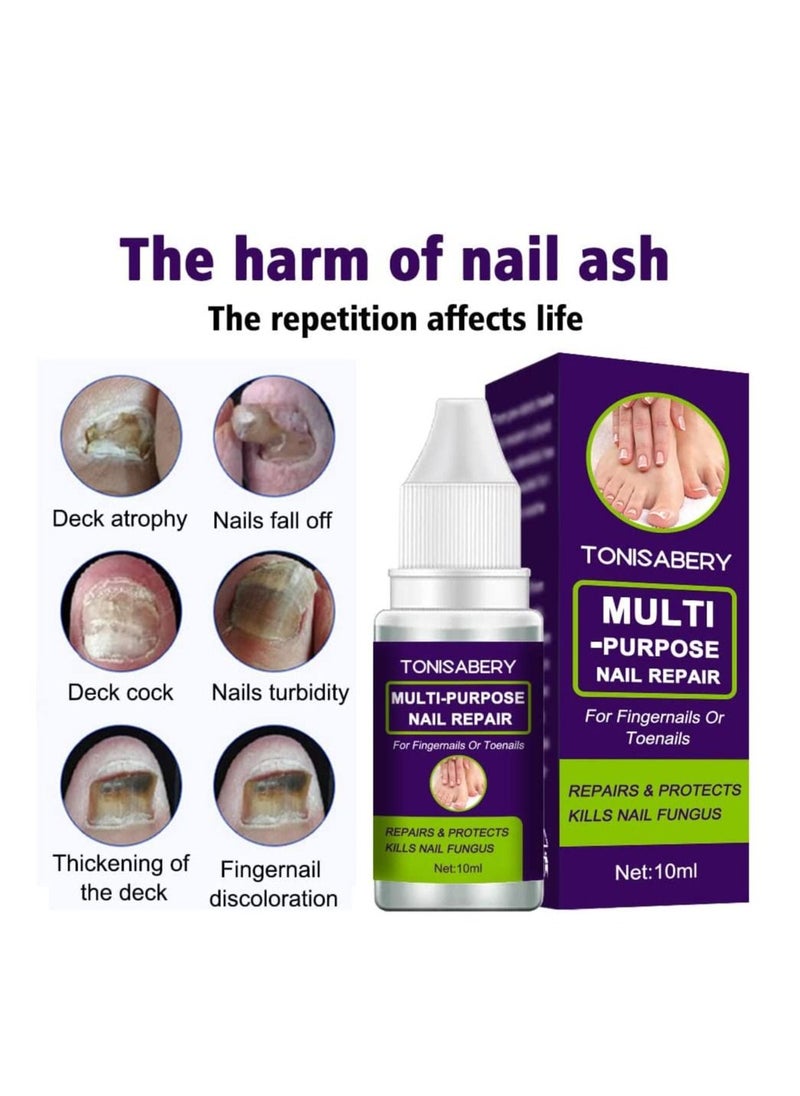 TONISABERY - Fungal Nail Repair Solution Natural Safe & Effective Repairs Protects Cuticles Removes Nail Infections Nourishing Fluid for Fingernails Toenails Remove Onychomycosis Unisex 10ml - Image 1