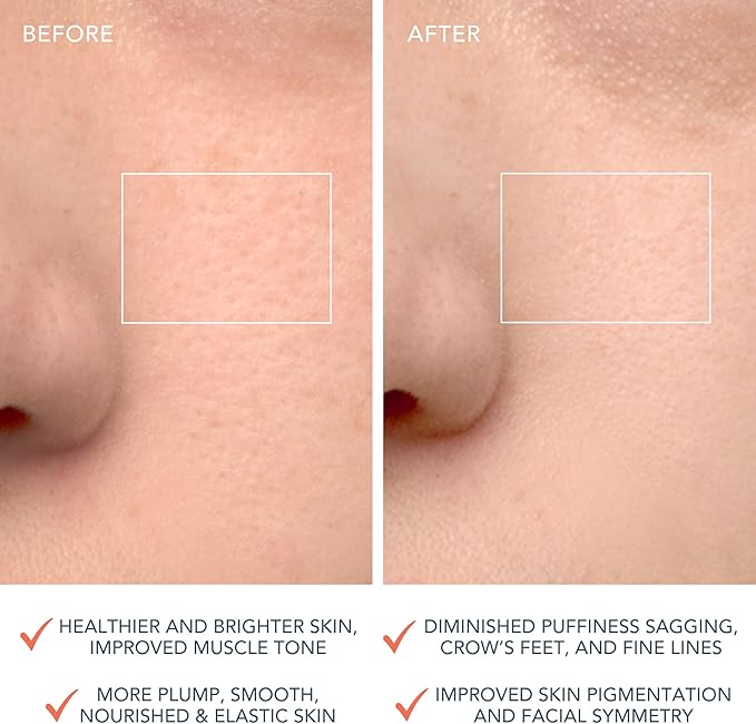 FOREO Clean Balance Luna 4 Bundle Facial Cleansing Brush for Sensitive Skin Luna MicroFoam Face Cleanser 20 100 ml Firming Face Massager - Image 5