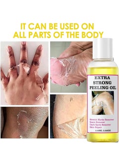 MOOYAM Super Strength Yellow Peeling Oil Exfoliating Dark Skin for Body  - Image 2