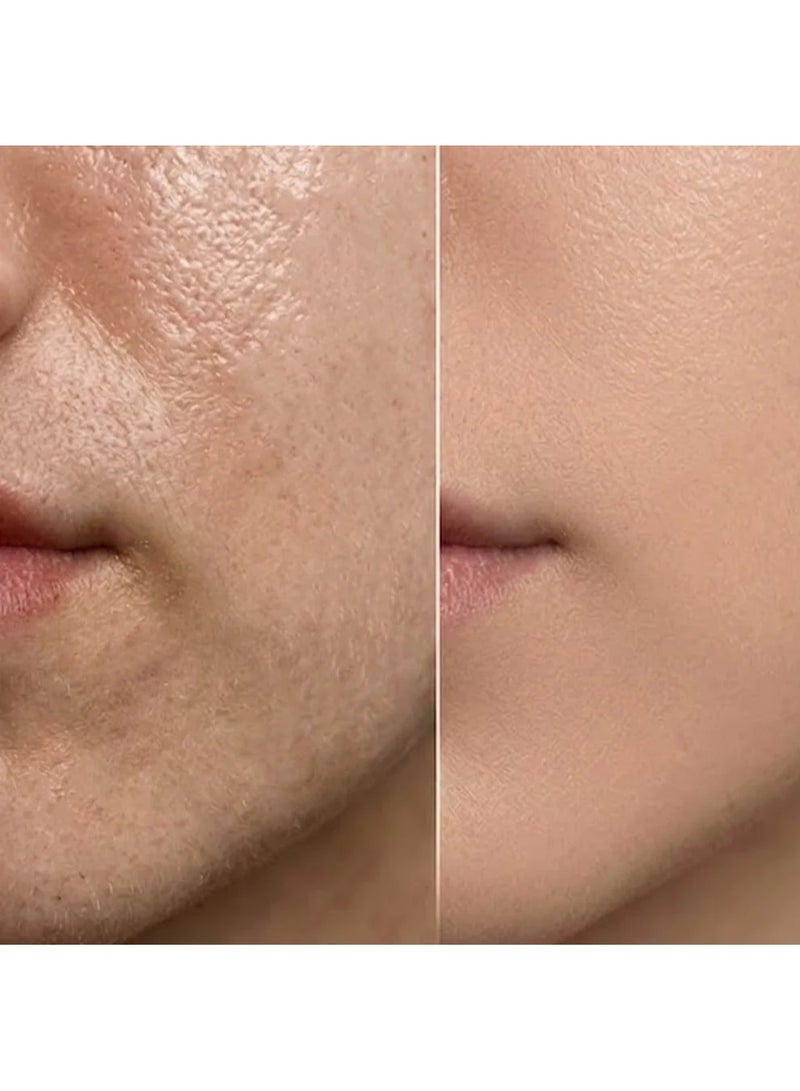 EUREKA Kiara Emollient Cream for Oily, Combination and Acne Prone Skin 120 gm - Image 2