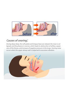 OUHOE Anti-Snore Nasal Spray for Clean the Nasal Cavity,Prevent Snoring and Relieve Breathing Difficulties  - Image 4