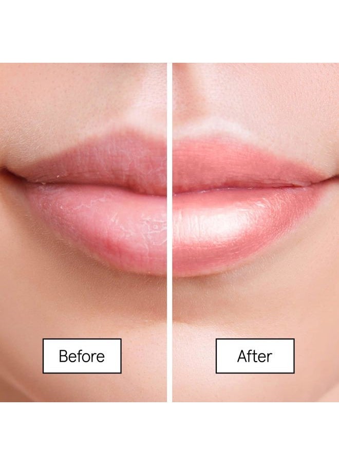 Grace & Stella - Grace & Stella Award Winning Lip Plumper Nourishing Berry Lip Mask - Lip Balm Hydrating - Lip Moisturizer For Very Dry Lips - Overnight Lip Mask & Lip Treatment & Lip Sleeping Mask - Vegan - Image 1