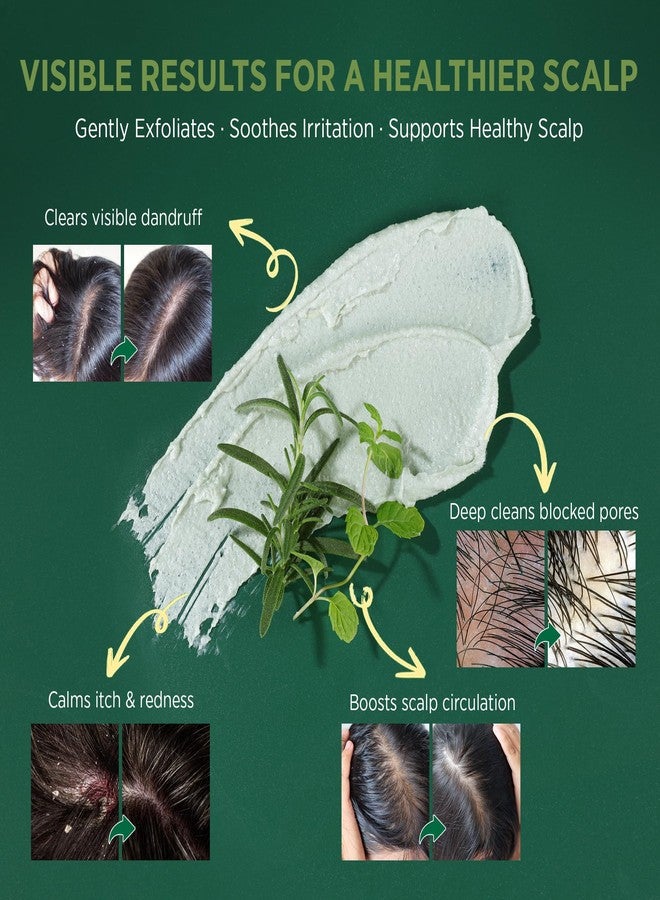 RoyceDerm Rosemary Mint Scalp Scrub Clarifying Scalp Exfoliator Refreshing Clean Scalp, Cooling Micro-Exfoliation with Botanical Extracts, For All Scalp Types (Rosemary Mint Scalp Scrub) - Image 4