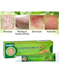 Sumifun Natural Chinese Herbal Eczema Psoriasis Creams 20g，Itchy Skin ...