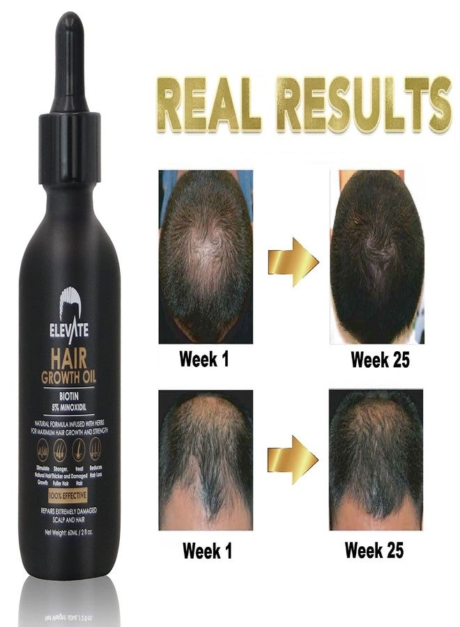 ELEVATE Hair Growth Oil - Biotin Serum & 5% Minoxidil Treatment for Stronger Thicker Longer Hair - Natural Thickening Treatment - Stop Thinning & Hair Loss for Men & Women 2oz - Image 5