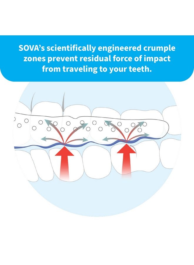 SOVA Aero Night Guard with Case - 1.6mm Thin - Custom-Molded Fit - Protects Against Nighttime Teeth Grinding & Clenching - Odor & Taste Free - Remoldable Up to 20 Times - Non Toxic - Image 4