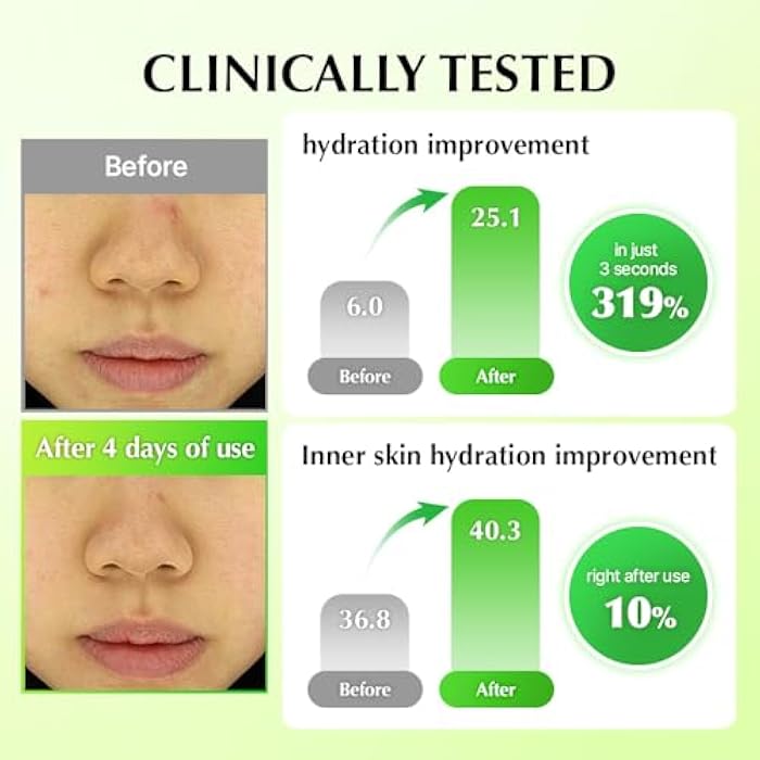 UIQ Biome Remedy Soothing Cream, Instant Soothing, Nourishing, Hydrating, Panthenol, Non Comedogenic, Hydrating daily facial moisturizer, Korean skincare 1.69 fl. oz. (50ml) - Image 3