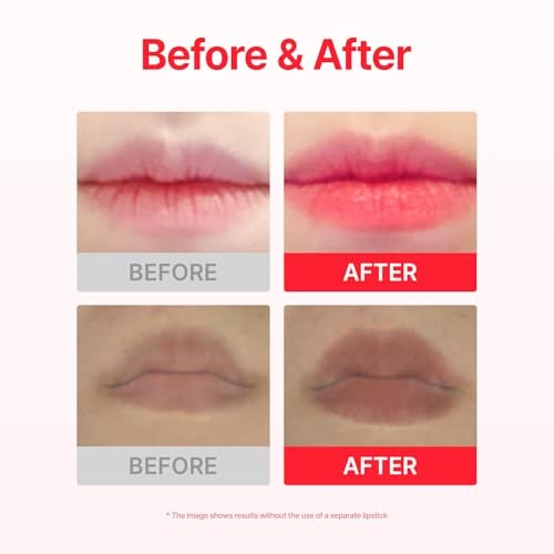 ACROPASS Jolly Filly Lip Patch, Helps Improve the Look of Smooth, Moisturized Lips, 30Minute Hydrating Lip Care with Cayenne Fruit Extract (2 Patches) - Image 4