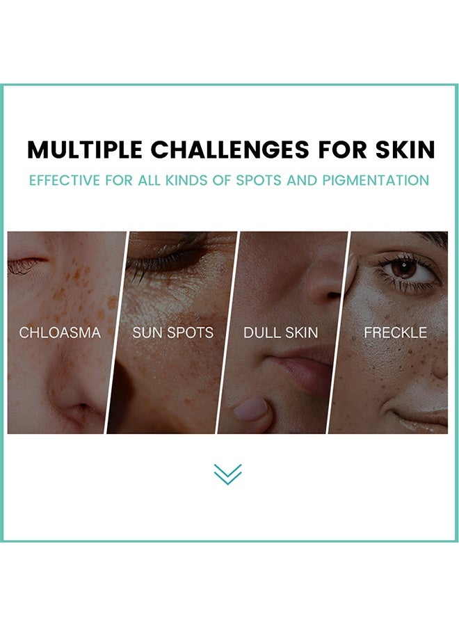 Sumifun Melasma Relief Cream，Pigmentation Removal Cream For Face, Freckle Remover Cream, Dark Spot Corrector Cream 20G - Image 3