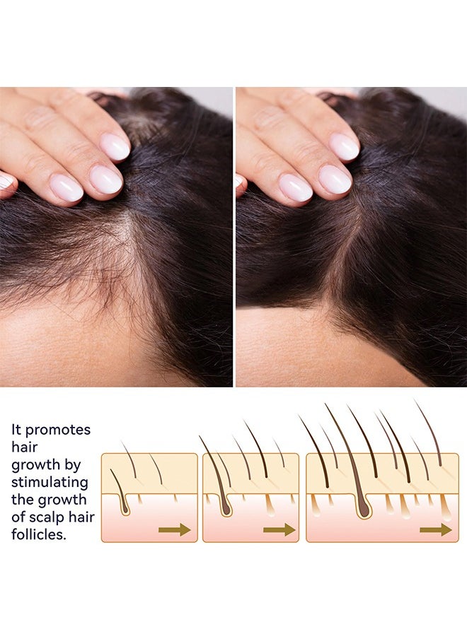 OUHOE - Hair Growth Spray, Hair Growth Serum Spray, Ultra Hair Growth Formula Serum Spray, Grow Thicker Hair In 8 Weeks - Image 1