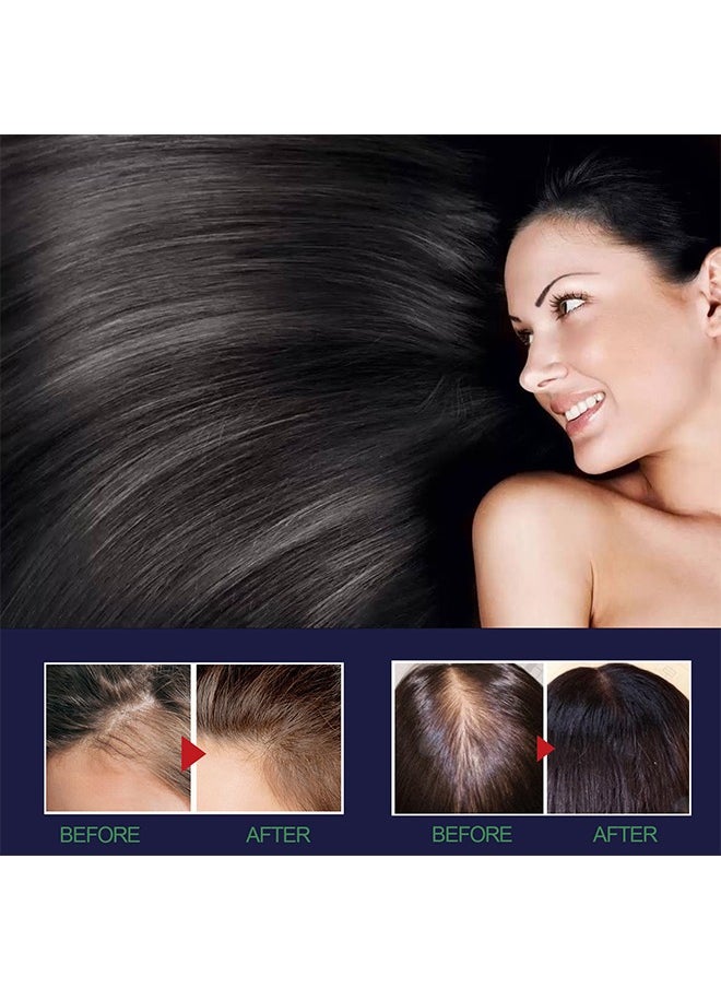 OUHOE - Hair Growth Spray, Hair Growth Serum Spray, Ultra Hair Growth Formula Serum Spray, Grow Thicker Hair In 8 Weeks - Image 1
