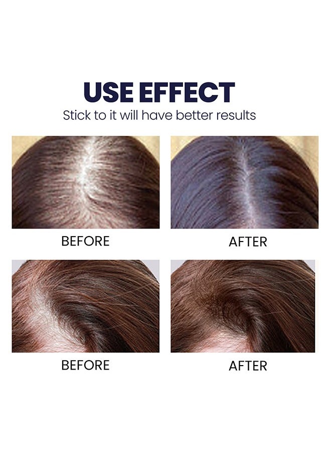 OUHOE - Hair Growth Spray, Hair Growth Serum Spray, Ultra Hair Growth Formula Serum Spray, Grow Thicker Hair In 8 Weeks - Image 1