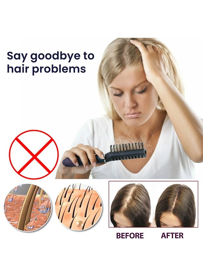 OUHOE - Hair Growth Spray, Hair Growth Serum Spray, Ultra Hair Growth Formula Serum Spray, Grow Thicker Hair In 8 Weeks - Image 1