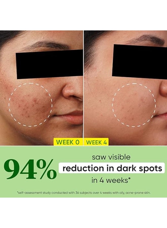 Dot & Key 10% Niacinamide + Cica Serum | Reduces Acne & Dark Spots | Niacinamide Serum | Controls Excess Oil, Quick Absorbing, & Lightweight | For Oily, Acne Prone & Sensitive Skin | 30ml - Image 5